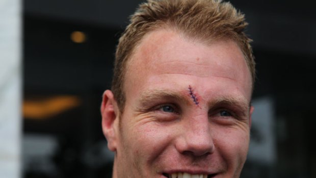 Splitting headache ... NSW star Luke Lewis bears the scars of battle after Origin II but it is a hamstring injury that is causing him and the Blues most concern.