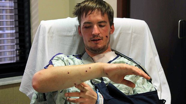 Cinema-goer Stephen Barton shows his injuries in a Colorado hospital.