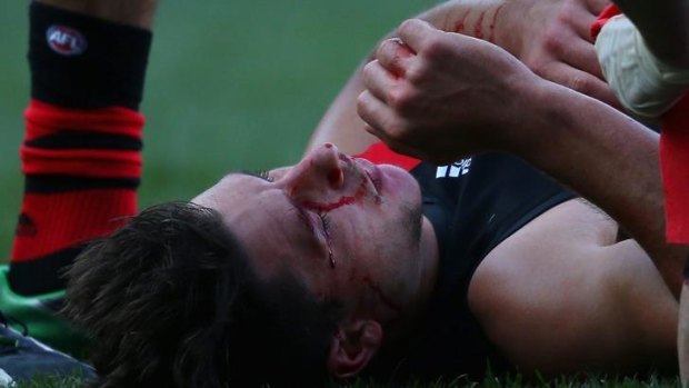 Mark Baguley of the Bombers lies on the ground after taking a knock to the head during the match against Carlton.