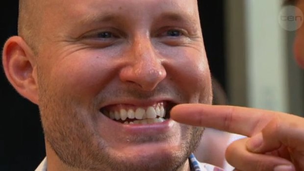 Kevin shows off his cracked tooth.