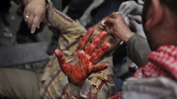 A wounded anti-government protester displays a bloodied hand as he is carried away from clashes with regime supporters.