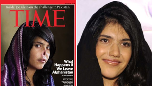 Aisha's appearance on the front page of <i>Time</i> magazine (left), before her face was rebuilt by doctors (right).