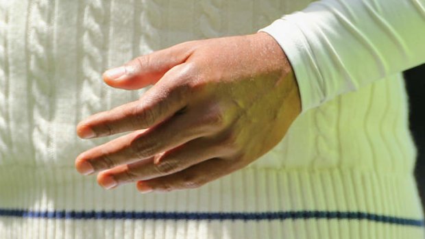 Kumar Sangakkara's injured hand.