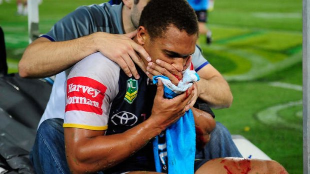 The damage done: Ray Thompson's jaw was broken in two places after the hit from Snowden.
