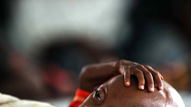 Eleven-month-old Abdifatah Hassan is suffering severe malnutrition as famine hits East Africa.