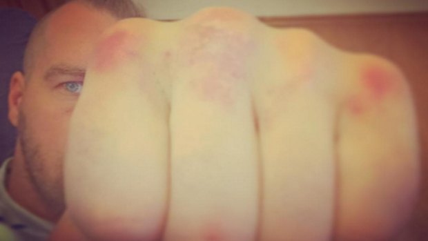 Mark de Mori's hands bear witness to the road he has travelled to his fight against David Haye.