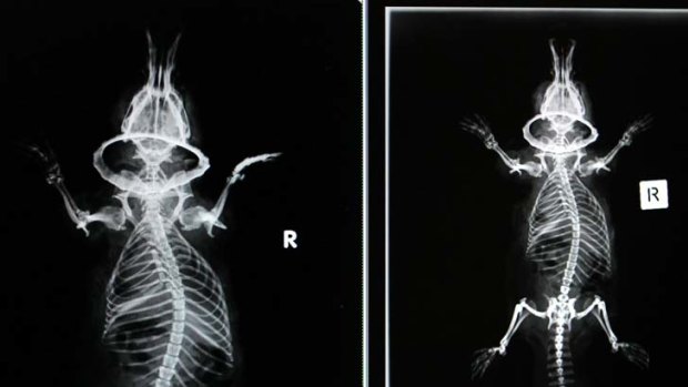 X-rays showed no broken bones.