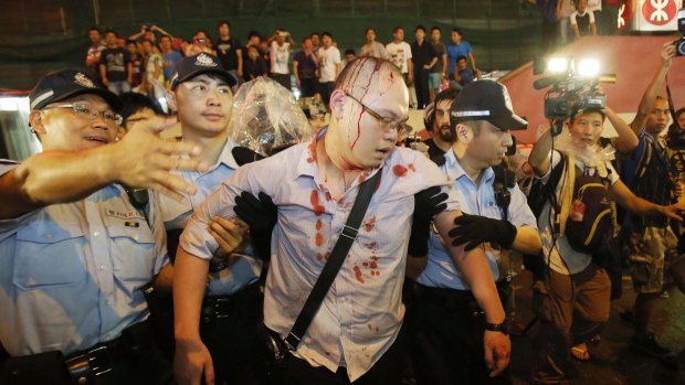 Police take an injured man from the confrontation of pro-democracy student protesters and angry local residents in Mong Kok, Hong Kong.