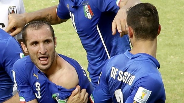 Italy's Giorgio Chiellini displays his shoulder showing apparent teeth marks.