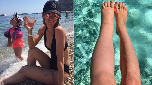 Sarah Buller's left leg now weighs 12 kilograms and is twice the size of her right one.