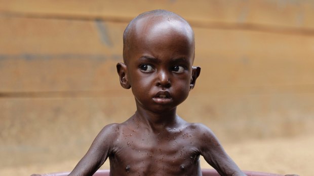 Two-year-old Aden Salaad, in 2011, a refugee in Dadaab, Kenya. Africa has a keen interest in reducing global warming risks given its exposure to extreme weather and widespread poverty.