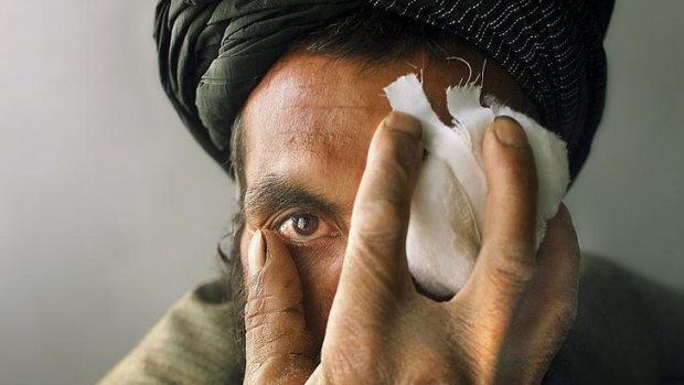 Fazal Muhammad is treated for an eye wound in Quetta, Pakistan. PICTURE: VINCENT LAFORET/NEW YORK TIMES