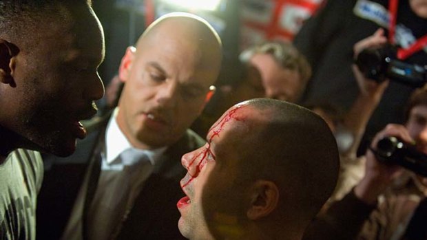 Cut open ... David Haye's trainer Adam Booth was left with a cut head.