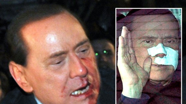 Silvio Berlusconi on the day of the assault and (inset) leaving hospital last week.