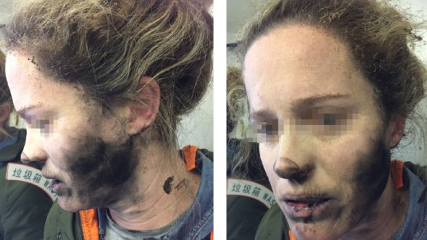 The woman was badly burnt when her headphones exploded on a flight from Beijing to Melbourne.