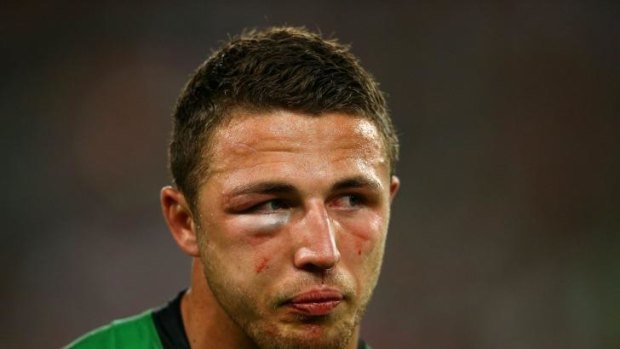 Sam Burgess was allowed to play on during the NRL Grand Final despite having a fractured cheekbone and eye socket.