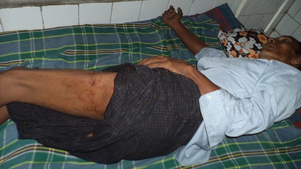 A Rakhine Buddhist man injured in the violence lies on a bed at a hospital in Sittwe.