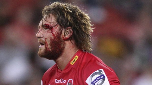 In the wars ... Scott Higginbotham took a sore one for the Reds on Saturday night.