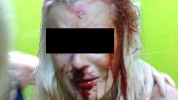 The photo of the alleged victim posted on Facebook ...