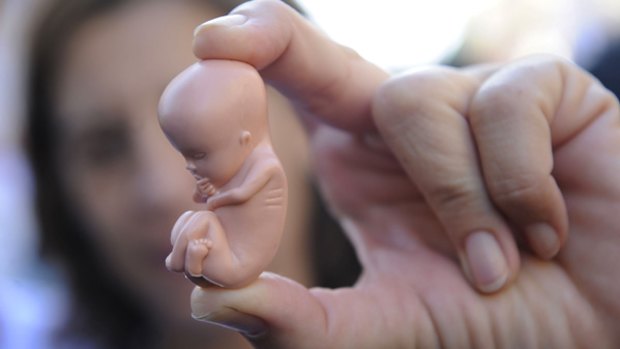 A protester holds a plastic foetus.