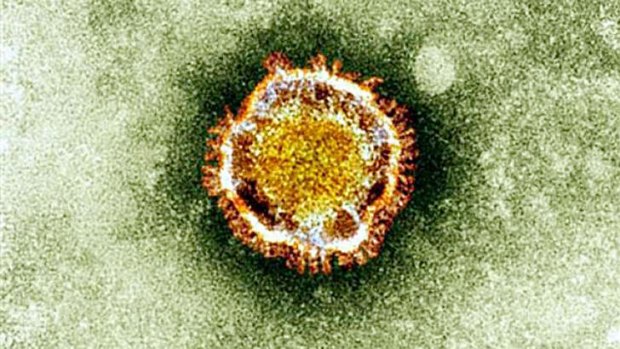 The Coronavirus seen under an electron miscroscope.