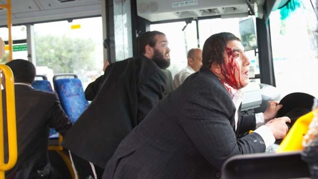 An injured Jew after a bus he was travelling in was attacked by Palestinians in Jerusalem in September.