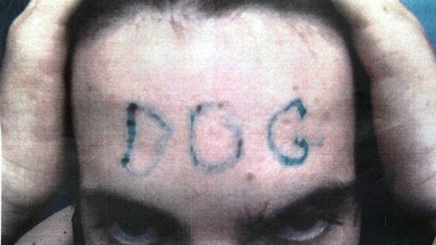 The victim shows what was done to his forehead in this police photograph.