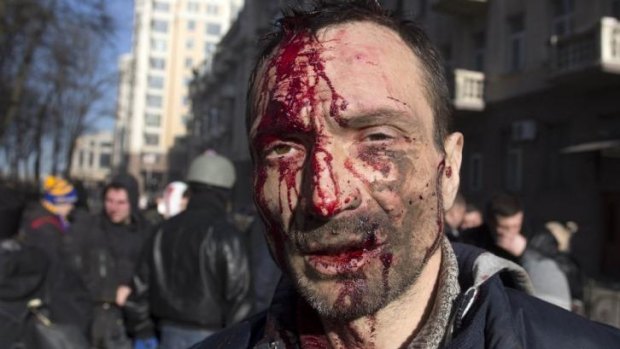 Bloody street riot ... A man looks on after being injured in clashes between anti-government protesters and Ukrainian riot police.