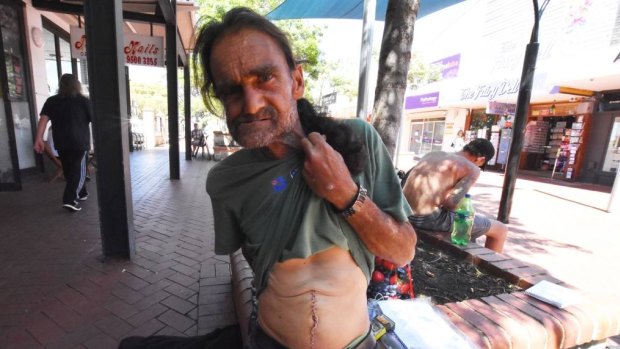 Stitched up: Homeless man Dave required life-saving surgery.