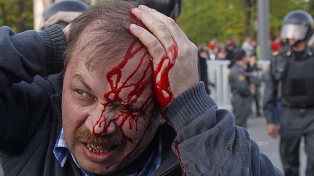 A wounded opposition protester winces in pain during a rally in Moscow.
