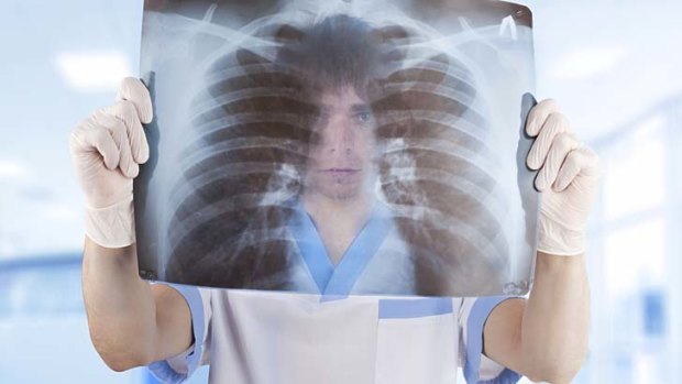 Lung cancer: Early detection could save 1500 lives a year in Australia.