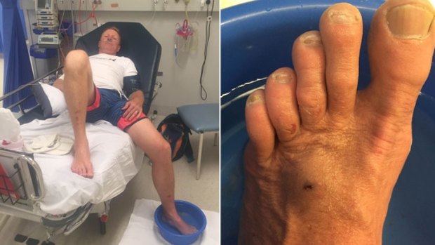Former Eagle great Karl Langdon in hospital after getting stung by a stingray and on the right his swollen. 