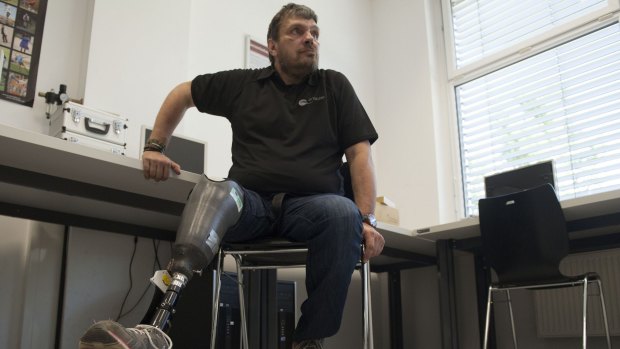 Wolfgang Rangger, a patient of Professor Hubert Egger, of Linz University, poses with his "feeling leg prosthesis" in Linz on Monday.