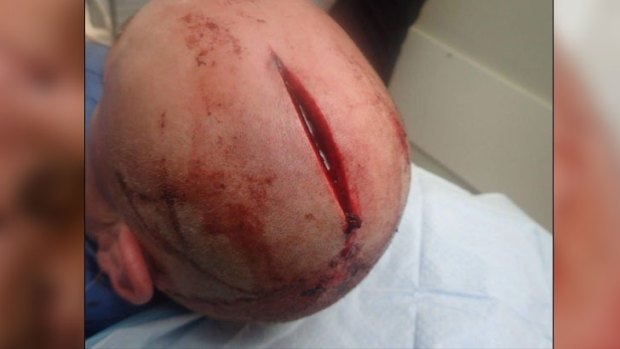 The father-of-four was left with a huge gash on his head from the alleged attack.