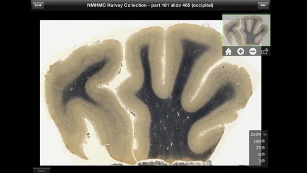 A screenshot of the iPad app shows an image of brain tissue from renowned theoretical physicist Albert Einstein.