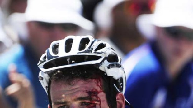 Battered ... British rider Mark Cavendish crosses the finish line after being caught up in yesterday’s crashes.