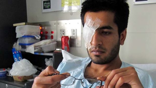 Ali Arshad, 24, says one of the lenses from his glasses was smashed into his right eye during the attack.
