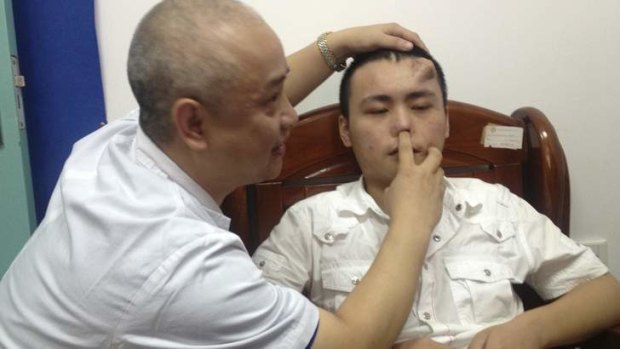 A doctor checks the infected and deformed nose of Xiaolian.