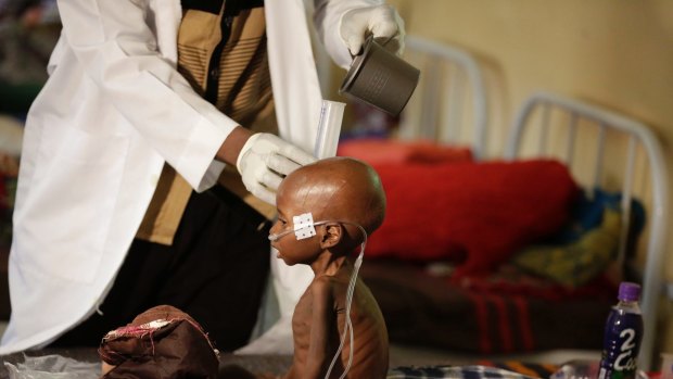 A malnourished child receives heath care in Maiduguri Nigeria in 2016. 