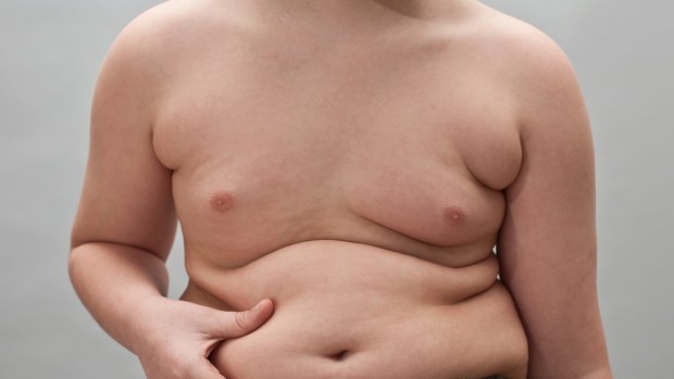 Childhood Obesity: Who's to blame? 