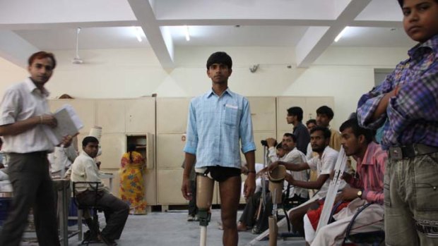 19-year-old Tileshwar Prasad admires his new Jaipur Foot and Stanford-Jaipur knee. The new prosthetics cost a total of $65 to make, and cost him nothing. He is walking freely for the first time in a decade.