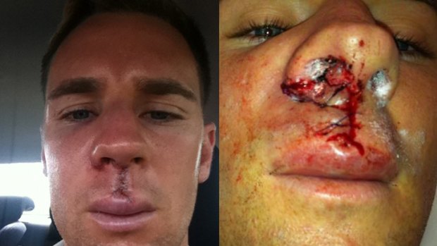 Shane Smeltz after being stitched up following what he called the most painful game he's ever played, in photos posted on Twitter.