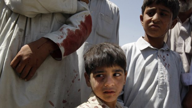 Injured Afghan youths gather at the site of a suicide car bomb attack in  the outskirts of Kabul.