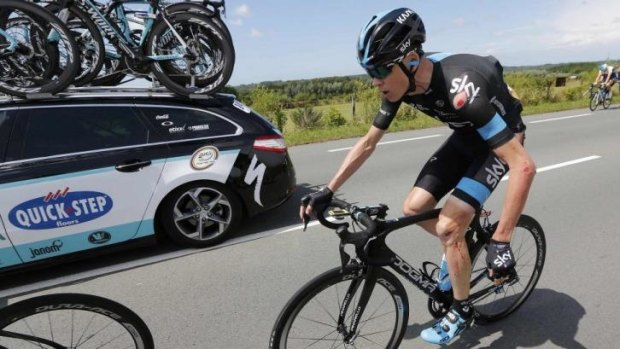 Froome dangles his injured left wrist as the cuts and grazes cover the left-side of his body.
