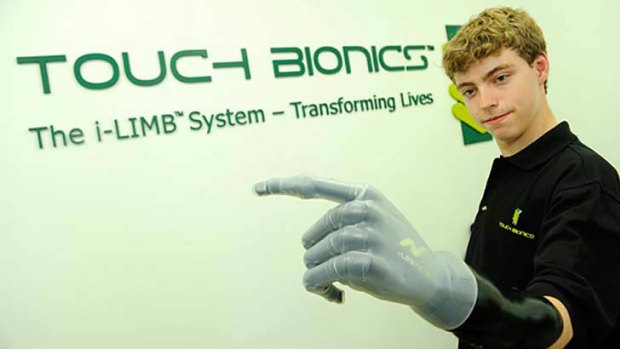 Matthew James with his new bionic hand.