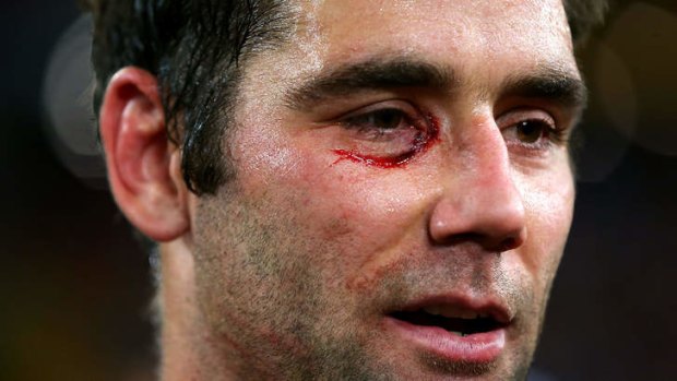 Eye of the storm: Maroons skipper Cameron Smith shows the signs of battle after Origin II in Brisbane.