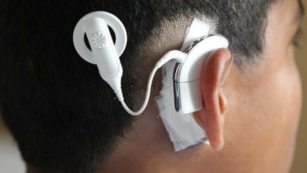 Cochlear is facing bionic ear competition from Swiss company Sonova.