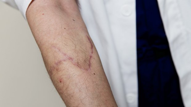 The scars on Dr Wong's arm after the attack in February 2014.