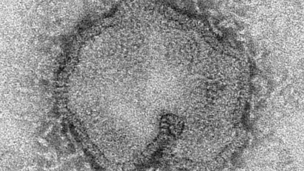 The H7N9 virus.