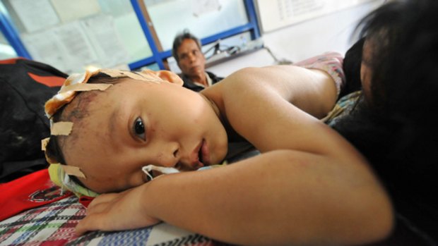 An Indonesian boy injured by the quake  lies in a hospital in Padang.